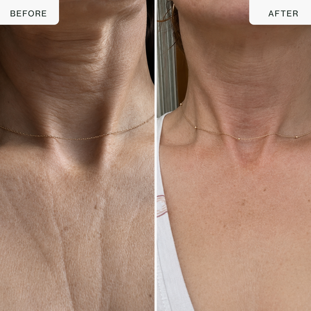 Pro LED Neck & Décolleté Mask — 850nm Near-Infrared Therapy