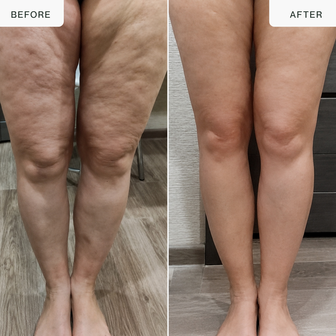 Body Sculpt Activating Cream