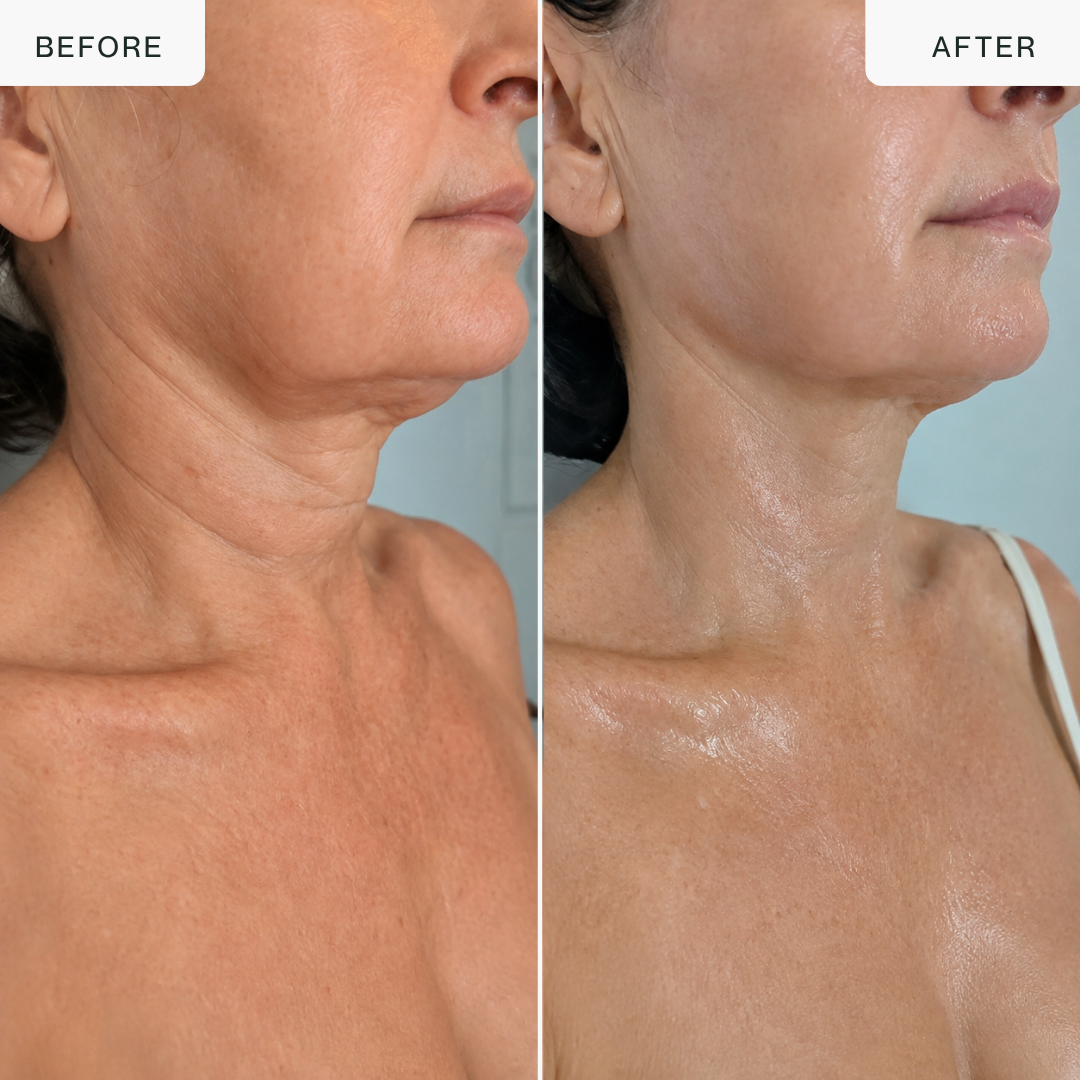 Pro LED Neck & Décolleté Mask — 850nm Near-Infrared Therapy