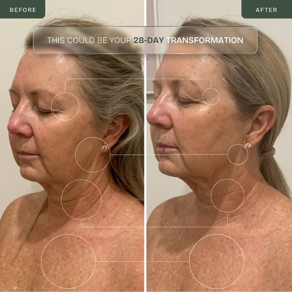 The Complete Anti-Aging LED Kit — Face, Neck & Décolleté Duo
