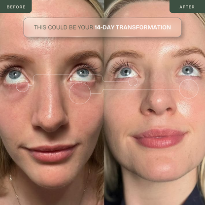Eye Repair Wand — 630nm Red LED + EMS Microcurrent