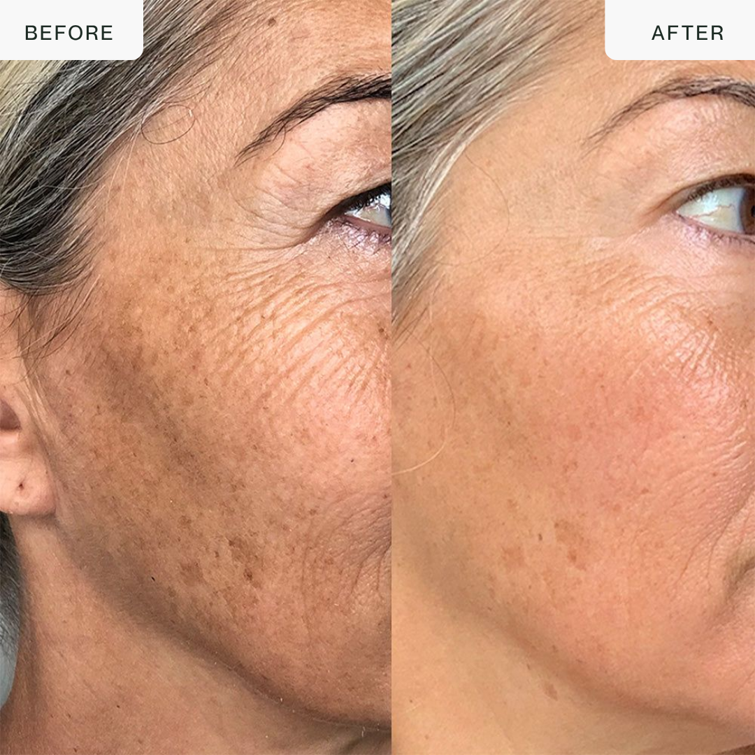 Pro LED Face Mask — 850nm Near-Infrared & Red Light Therapy