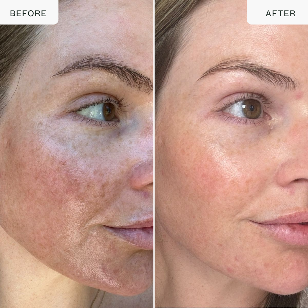 Pro LED Face Mask — 850nm Near-Infrared & Red Light Therapy