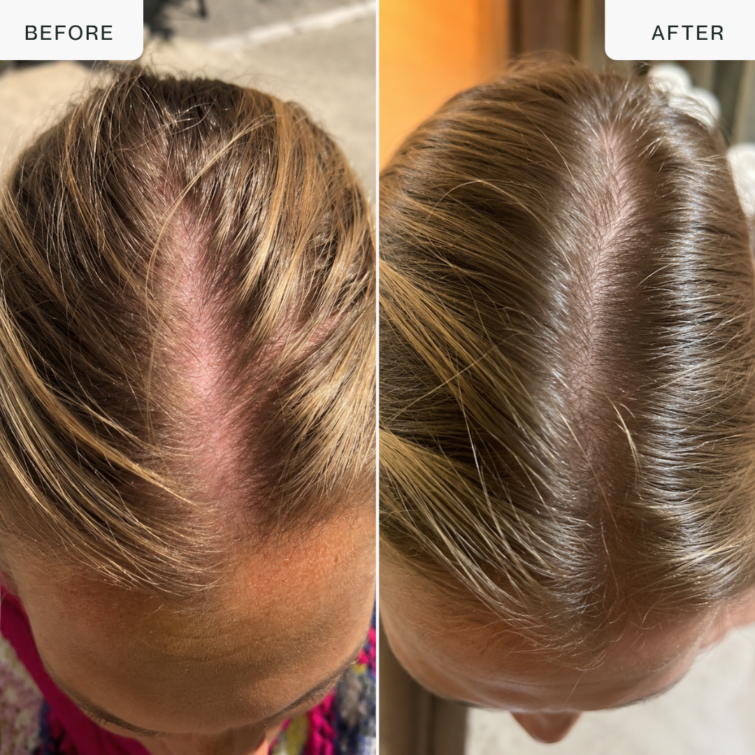 Hair Growth LED Comb — 850nm Infrared + EMS Microcurrent